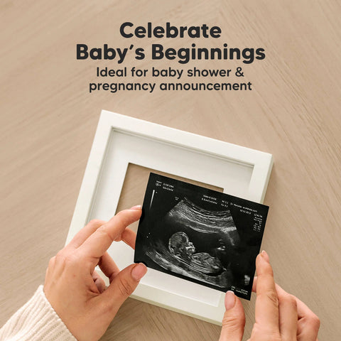 KeaBabies Solo Baby Sonogram Frame, Petal Pink, Display Baby Sonogram Picture, Elegant Nursery Decor, Keepsake Memory Frame, Perfect Newborn Gift, Cherish Early Baby Moments