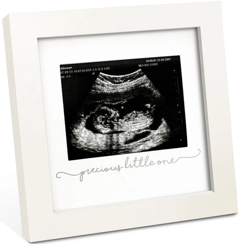 KeaBabies Solo Baby Sonogram Frame, Alpine White, Display Baby Sonogram Picture, Elegant Nursery Decor, Keepsake Memory Frame, Perfect Newborn Gift, Treasure Early Pregnancy Moments