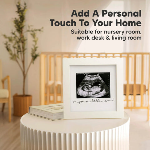 KeaBabies Solo Baby Sonogram Frame, Alpine White, Display Baby Sonogram Picture, Elegant Nursery Decor, Keepsake Memory Frame, Perfect Newborn Gift, Treasure Early Pregnancy Moments