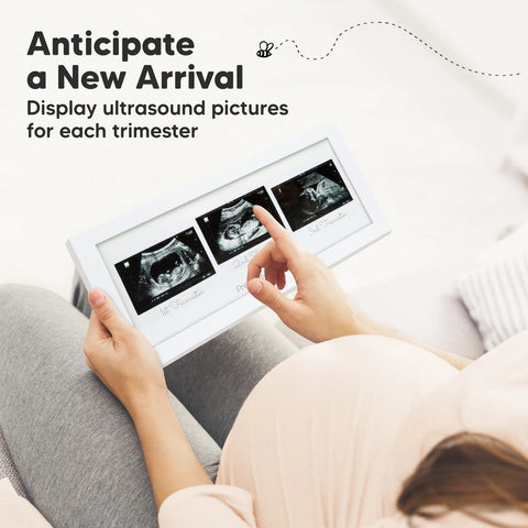 KeaBabies Trio Baby Sonogram Frame, Alpine White, Display Three Sonogram Pictures, Elegant Keepsake Frame for Nursery, Preserve Baby’s Early Memories, Thoughtful Gift for Expecting Parents