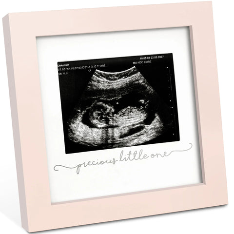 KeaBabies Solo Baby Sonogram Frame, Petal Pink, Display Baby Sonogram Picture, Elegant Nursery Decor, Keepsake Memory Frame, Perfect Newborn Gift, Cherish Early Baby Moments