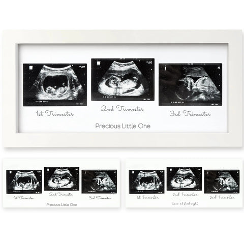KeaBabies Trio Baby Sonogram Frame, Alpine White, Display Three Sonogram Pictures, Elegant Keepsake Frame for Nursery, Preserve Baby’s Early Memories, Thoughtful Gift for Expecting Parents