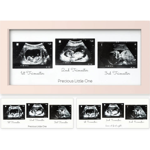 KeaBabies Trio Baby Sonogram Frame, Petal Pink, Display 3 Ultrasound Photos, Baby Keepsake Frame, Nursery Decor, Pregnancy Memory Gift for Expecting Parents